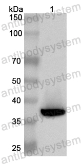 Anti-Human FKBP6 Polyclonal Antibody