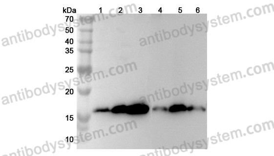 Anti-Human TBCA Polyclonal Antibody