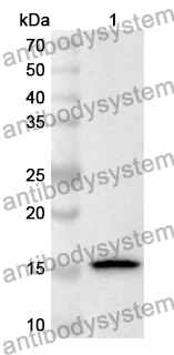 Anti-Human ATP6V1G1 Polyclonal Antibody