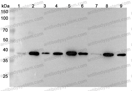 Anti-MACROH2A1 Polyclonal Antibody