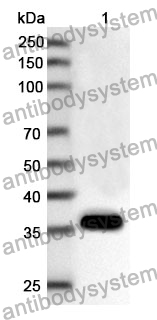 Anti-Human NDUFS6 Polyclonal Antibody