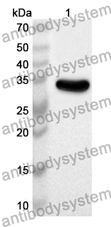 Anti-Human PEX14 Polyclonal Antibody