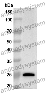 Anti-CS Polyclonal Antibody