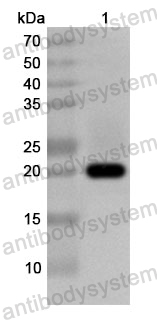 Anti-Human SEC22B Polyclonal Antibody