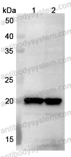 Anti-NME6 Polyclonal Antibody