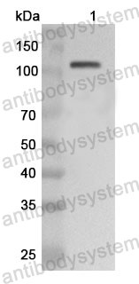 Anti-Human POLQ Polyclonal Antibody