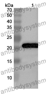 Anti-KATNA1 Polyclonal Antibody