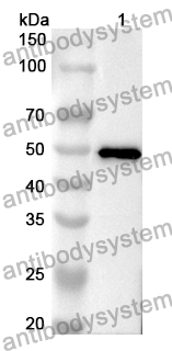 Anti-ERN1 Polyclonal Antibody