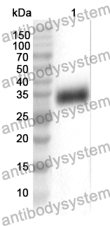 Anti-NR1I2 Polyclonal Antibody