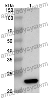 Anti-LGR5 Polyclonal Antibody