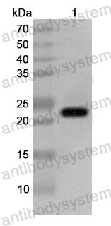 Anti-Human PSIP1 Polyclonal Antibody