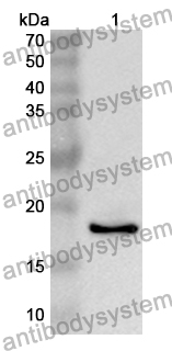 Anti-Human ERLIN1 Polyclonal Antibody