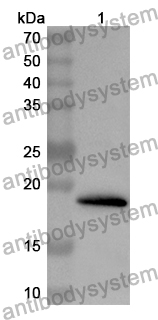 Anti-Human CLDN11 Polyclonal Antibody