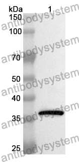 Anti-EED Polyclonal Antibody