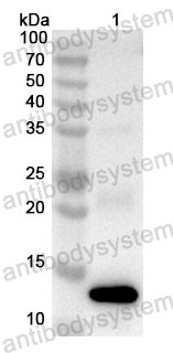 Anti-Human CSDE1 Polyclonal Antibody