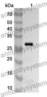 Anti-Human SKAP2 Polyclonal Antibody