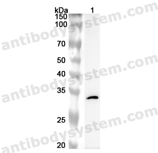 Anti-Human PRKRA Polyclonal Antibody