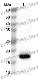 Anti-Human CRCP Polyclonal Antibody