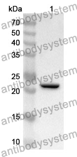 Anti-ITGA10 Polyclonal Antibody