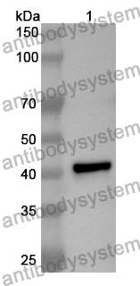 Anti-Human RPS6KA5 Polyclonal Antibody