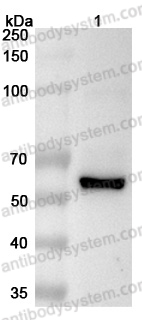 Anti-Human USP2 Polyclonal Antibody