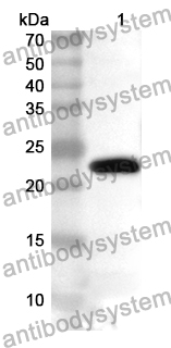 Anti-PRDM1 Polyclonal Antibody