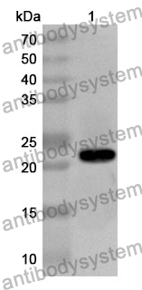 Anti-UPK3A Polyclonal Antibody