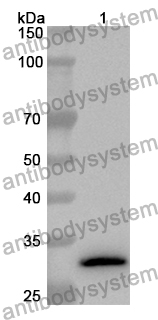 Anti-Human FCN3 Polyclonal Antibody