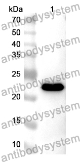 Anti-Human OFD1 Polyclonal Antibody