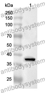 Anti-ADAP1 Polyclonal Antibody