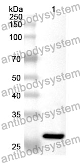 Anti-NUP155 Polyclonal Antibody