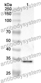 Anti-GJB3 Polyclonal Antibody