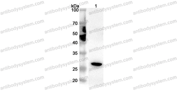 Anti-Human GPX5 Polyclonal Antibody