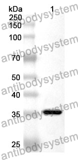 Anti-RNASEH2A Polyclonal Antibody