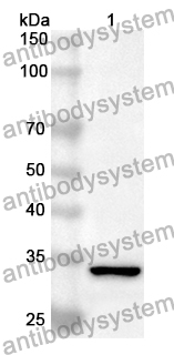 Anti-CBR3 Polyclonal Antibody