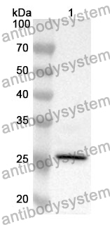 Anti-CNMD Polyclonal Antibody