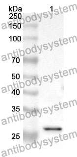 Anti-PSMD10 Polyclonal Antibody