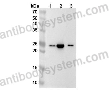 Anti-Human RBBP9 Polyclonal Antibody