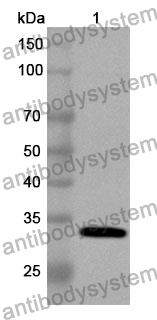 Anti-Human DHRS3 Polyclonal Antibody