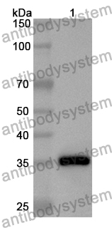 Anti-Human CABYR Polyclonal Antibody