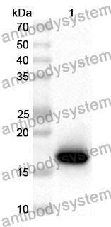 Anti-Human AKAP3 Polyclonal Antibody