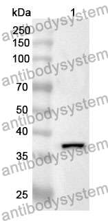 Anti-KRT33A Polyclonal Antibody