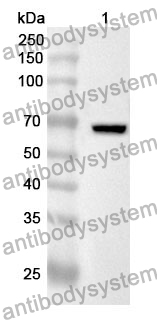 Anti-ANXA9 Polyclonal Antibody