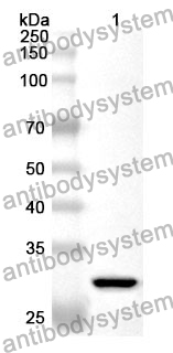 Anti-STC2 Polyclonal Antibody