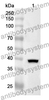 Anti-SNCG Polyclonal Antibody