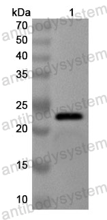 Anti-Human SLC22A5 Polyclonal Antibody