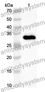 Anti-Human RECQL4 Polyclonal Antibody