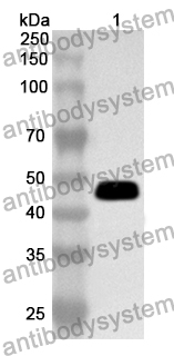 Anti-MTA2 Polyclonal Antibody