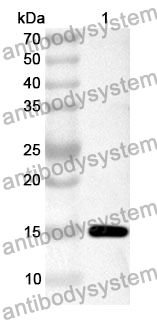 Anti-Human USP1 Polyclonal Antibody