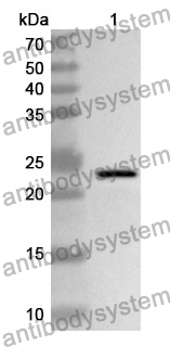 Anti-TPPP Polyclonal Antibody